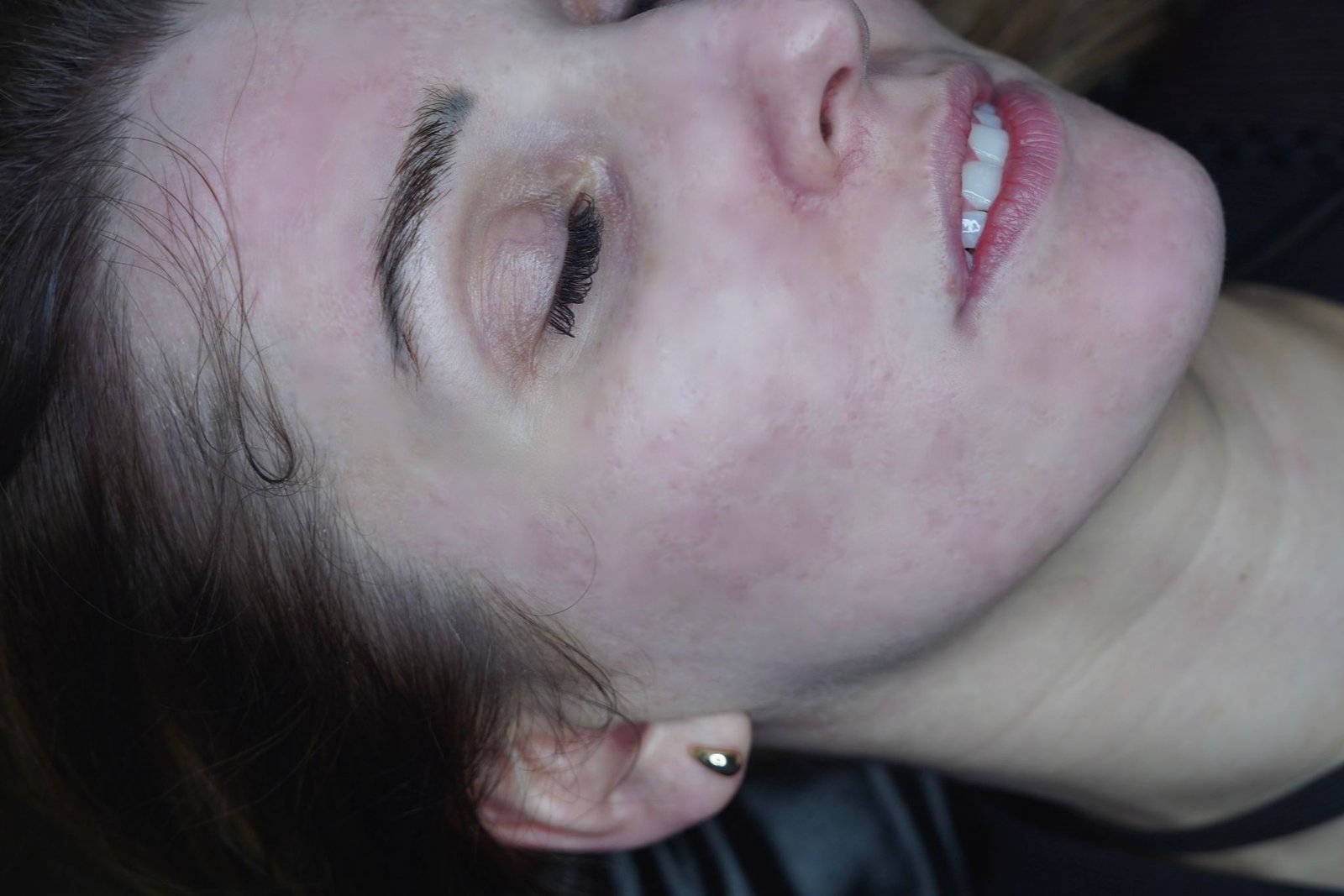 After treatment result 2