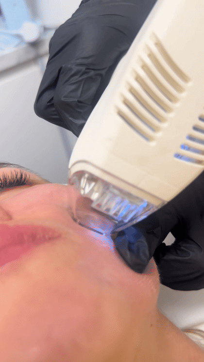 Close-up of a facial treatment